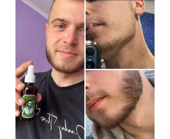 Лосьон для роста бороды Minox Beard Growth Lotion Minoxidil 7%, изображение 2