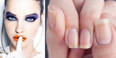 Заусенцы: причины возникновения и как от их избавиться