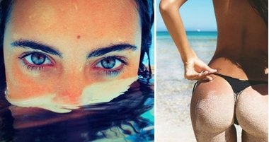 Берегись, целлюлит! – факторы его развития