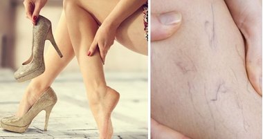 Берегите вены!