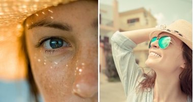 Боремся с пигментацией кожи