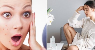 Демодекоз: симптомы, лечение и профилактика