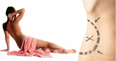 Фигура после липосакции: что можно и чего нельзя | Блог на Stylesalon.ua