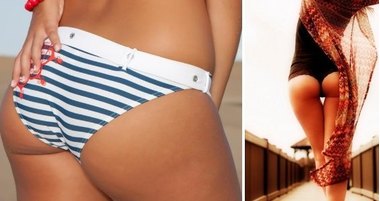 SOS: целлюлит!