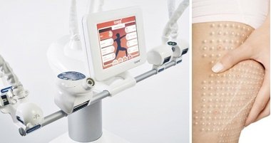 За 40+: моделирование тела аппаратом ICOONE