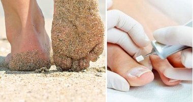 Ждем лето: приводим ножки в порядок