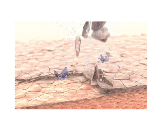 Аппарат для проведения микродермабразии IONTO-SKIN ABRASION Comfort