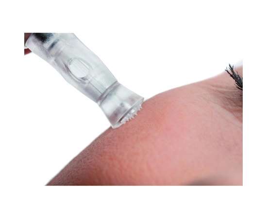 Аппарат микроигольчатой неинвазивной мезотерапии Ionto Meso SL