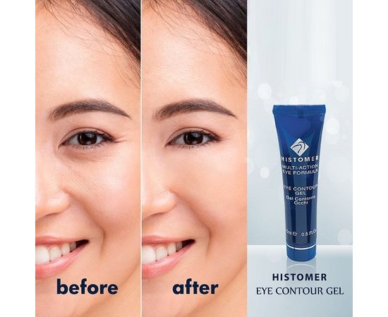 Гель для кожи вокруг глаз Histomer.
