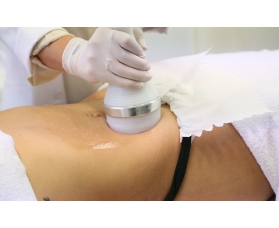 Body Health Апарат для кавітації КРІО RF ліфтинг і безголкового мезотерапії BHS 156 FULL, фото _ab__is.image_number.default