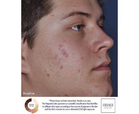 Obagi CLENZIderm Therapeutic Moisturizer Зволожуючий крем, 50 мл, фото _ab__is.image_number.default