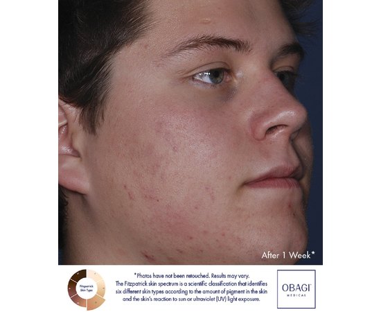 Obagi CLENZIderm Therapeutic Moisturizer Зволожуючий крем, 50 мл, фото _ab__is.image_number.default