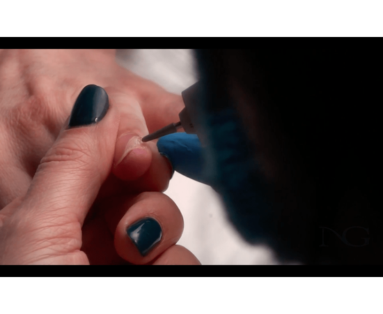 Онихолизис. Онлайн-семінар, фото _ab__is.image_number.default