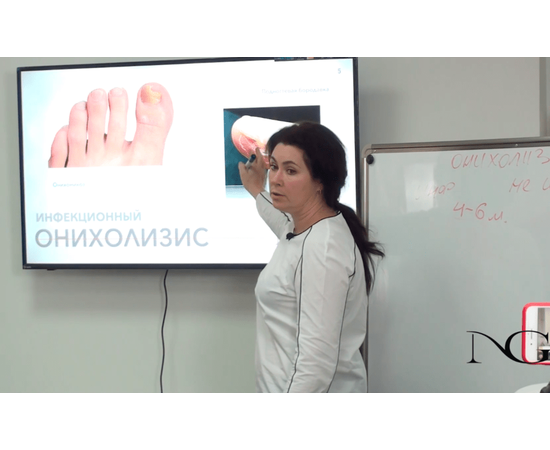 Онихолизис. Онлайн-семінар, фото _ab__is.image_number.default