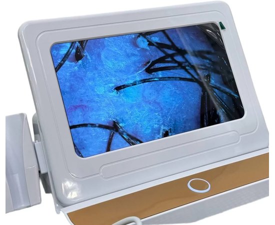 Трихоскоп для діагностики шкіри голови Keratex, фото _ab__is.image_number.default