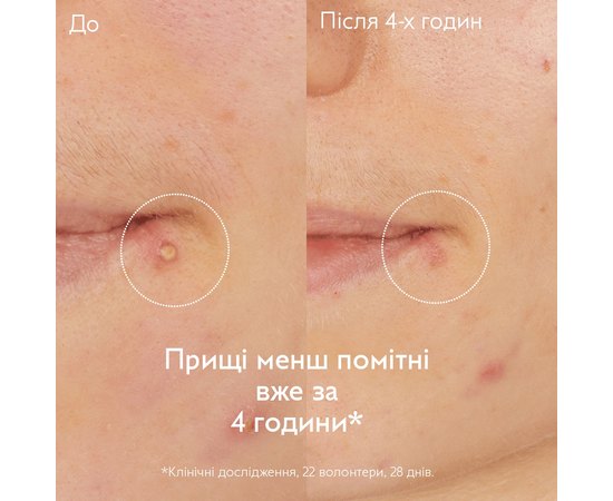 Точковий засіб проти недосконалостей Caudalie Vinopure Salicylic Spot Solution, 15 ml, фото _ab__is.image_number.default