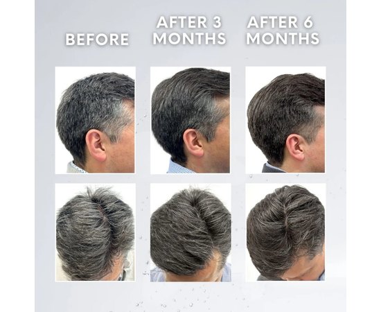 Лосьйон проти сивини Subrina Scalp Anti-Greying Lotion, 120 ml, фото _ab__is.image_number.default